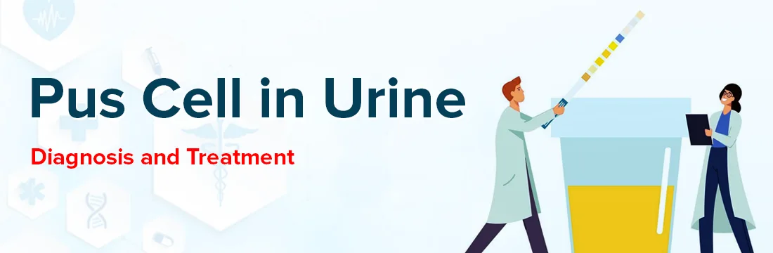 Pus Cell in Urine: Diagnosis and Treatment